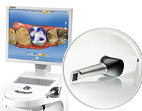 ��(gu��)���Z�¹�W(xu��)ȡģϵ�y(t��ng)