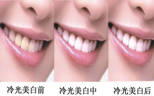 ���X�l(f��)�S�l(f��)����ô�k