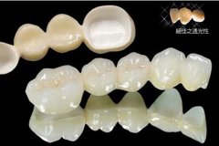 �N�����X���׹�Ч�Æ���