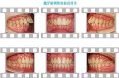 �����ί��_�������X