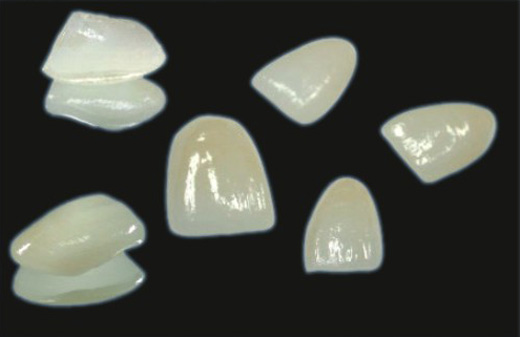 牙齒瓷貼面的價格貴不貴?