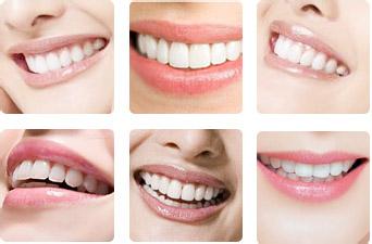 成人可以矯正齙牙嗎