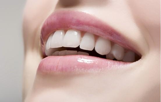 超聲波潔牙多少錢