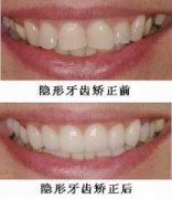 ���X�[�γC������Щ��(y��u)�c