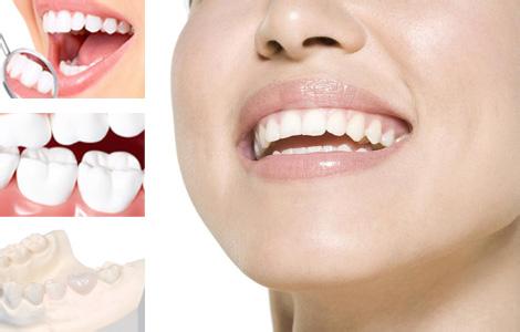 漳州鈷鉻烤瓷牙價格是多少