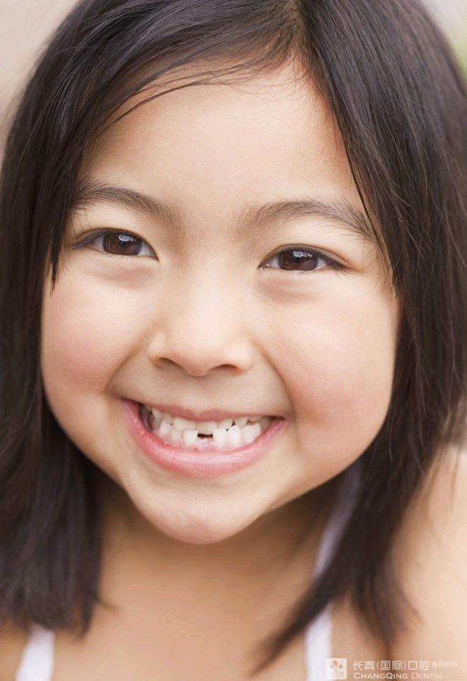 蛀牙是怎么形成的