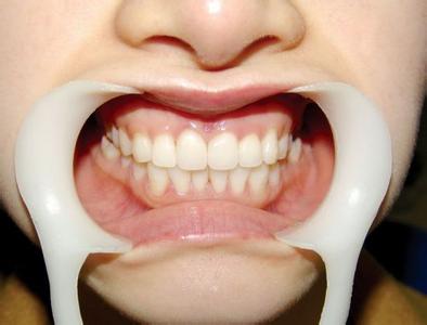 ����������ô�������