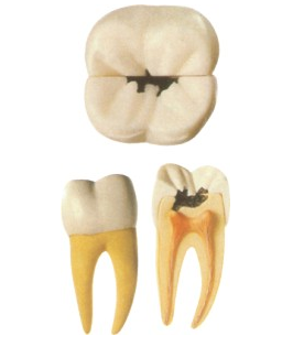 �����a��Ҫ�����X��