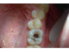 ��������ԭ����ʲô��