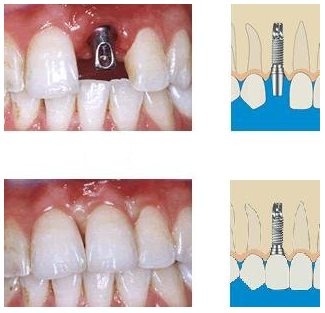 �Nֲ��ֲ������Щע�����