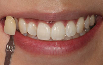 ʲô��������ɫ������