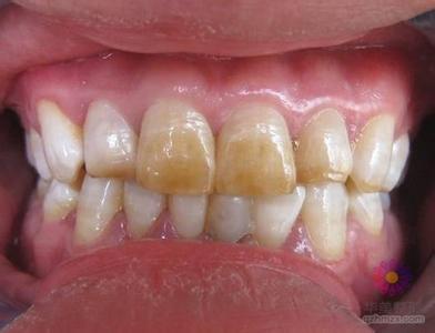 ���������׃r(ji��)����ʲôӰ�