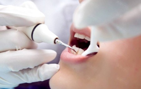 潔牙要多久才洗好