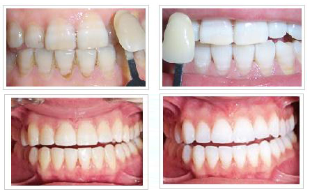 ���X�����ļ��t(y��)Ժ��