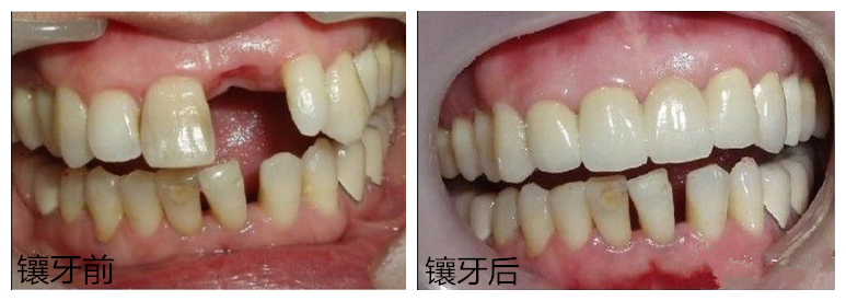 ������^�������ӵ���