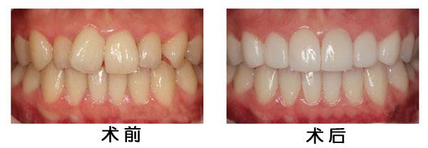 漳州做美容冠哪家醫(yī)院好