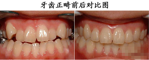 �_���C���ķ�������Щ