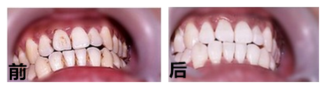 ����A(y��)����n��