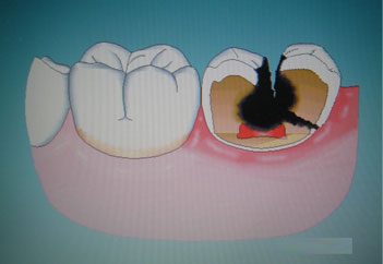 �a(b��)����֮��߀��������