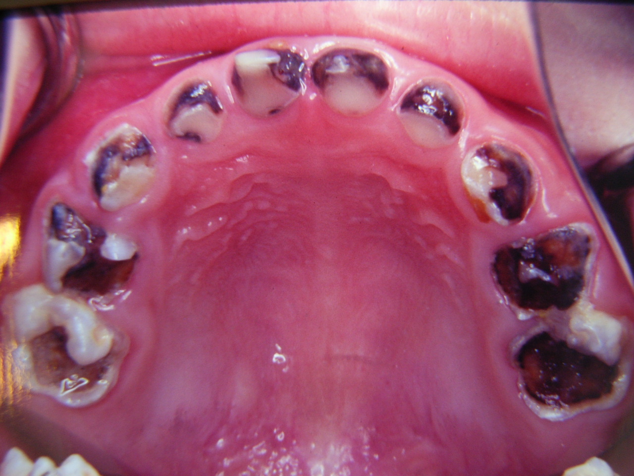 ����Щʳ������A(y��)������