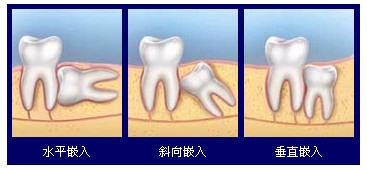 �������X�l(f��)����ʹ���k������Щ