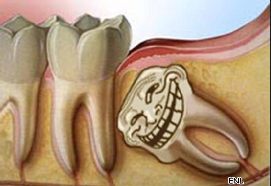 ��ʲôҪ�����X