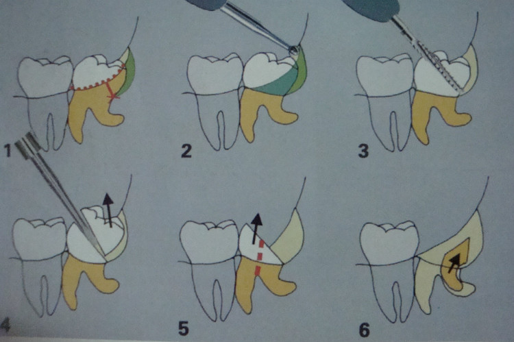 ���X�l(f��)����ô�k