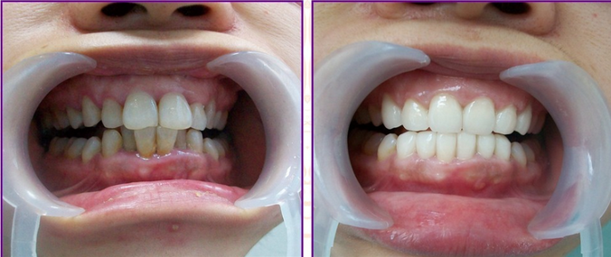 ���X���R�C�������X(qi��n)