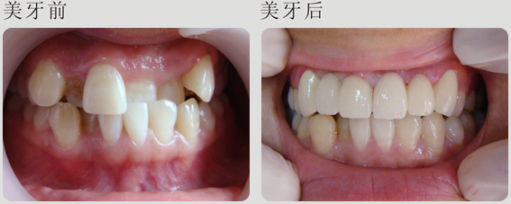 �������X���R���ԳC����