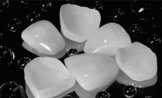 瓷貼面有哪些注意事項(xiàng)