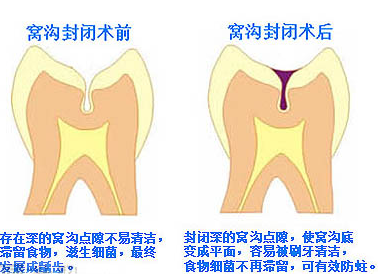 �C�Ϸ��]��ô�o(h��)��