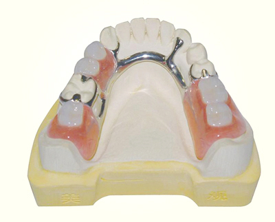 活動(dòng)義齒如何護(hù)理