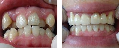 �������C���ķN��ʽ��