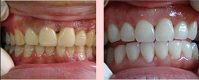 �S����ô�k