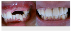 ǰ��ȱʧ��ô�k