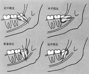 �L�����Xһ��Ҫ�Ά�