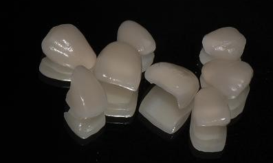 瓷貼面的適應癥有哪些