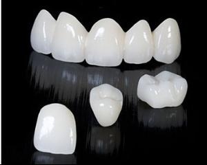 全瓷牙的優(yōu)勢(shì)有哪些