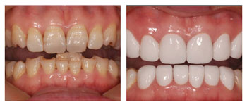 ȫ���������Ɇ�