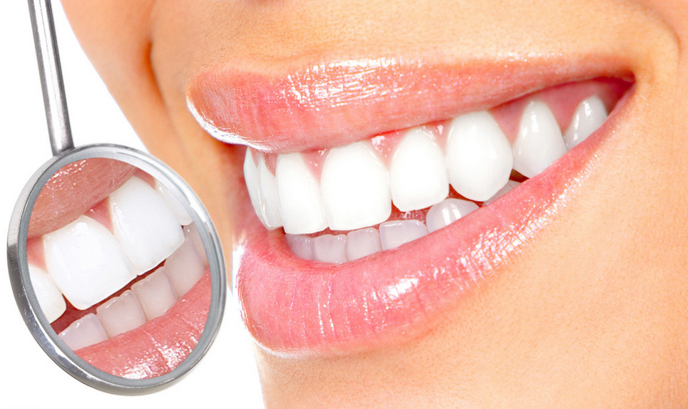 常見的牙齒美白問題
