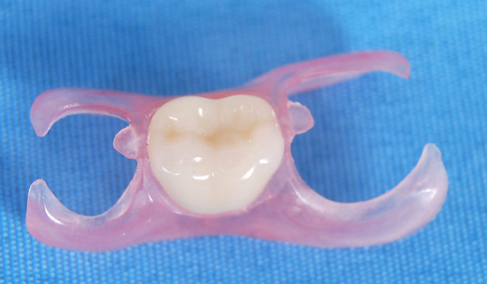 漳州鑲牙的過程