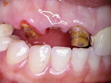 �������ǰ�߀������