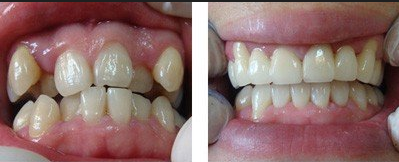 �������в��R��Σ��