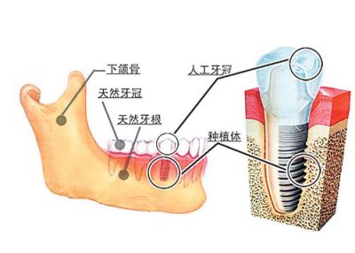 �������X���wȱʧ���Nֲ�Æ�