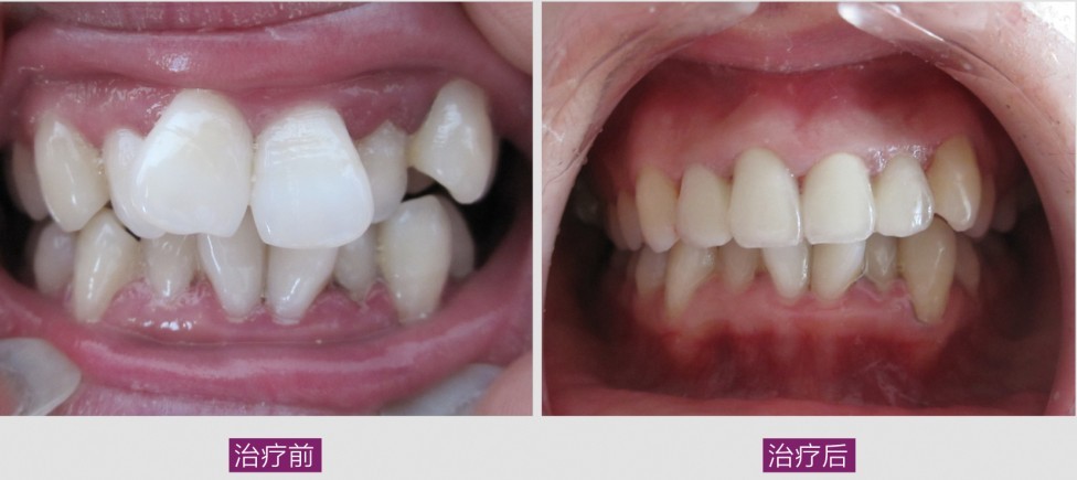 �������Г�D��ԭ��