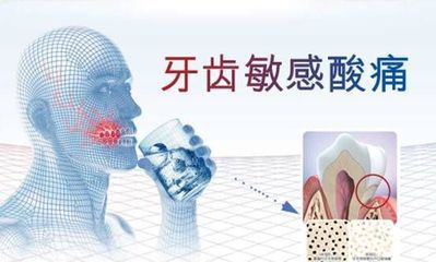 ���X����