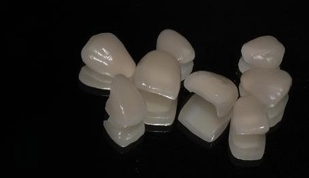 漳州瓷貼面有什么優(yōu)勢