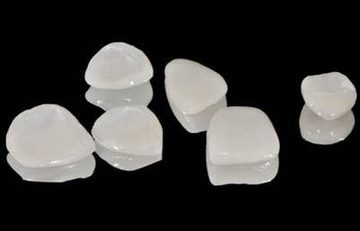 漳州關(guān)于瓷貼面你要知道的哪些事