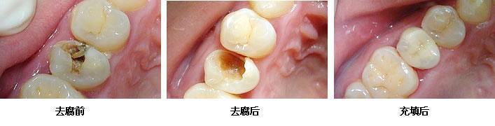 �����a(b��)��һ�w�����X