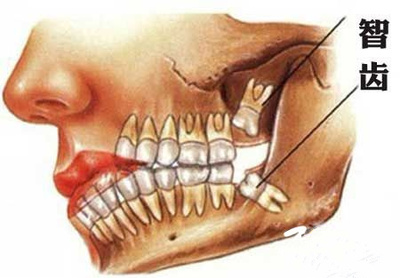 ���ݰ����X����Щע�����(xi��ng)